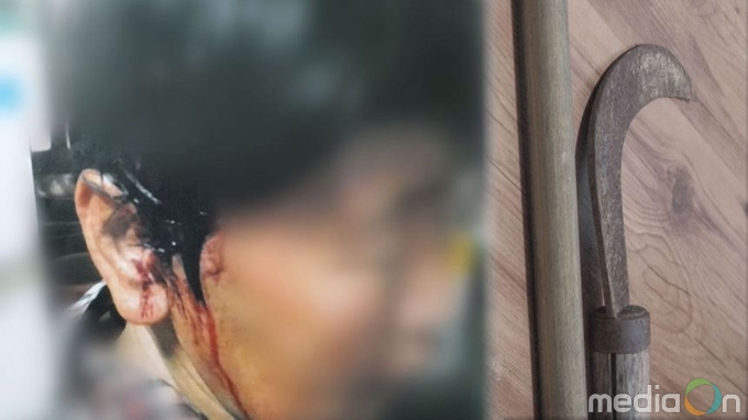 궁금한 이야기Y, 나는 시아버지의 노예였다. 선자 씨의 20년간 외침은 왜 외면당했나?